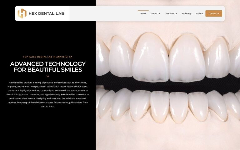 Hex Dental Lab Screenshot with Teeth