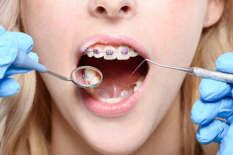 Cropped shot of dentist in latex gloves using a mouth mirror and periodontal probe on woman with