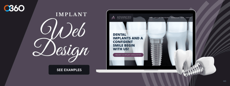 O360 Ad – Dental Implant Web Design